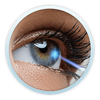 LASIK Procedure Example