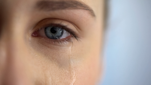 woman with dry eyes